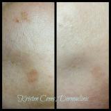 A recent spa job in the area